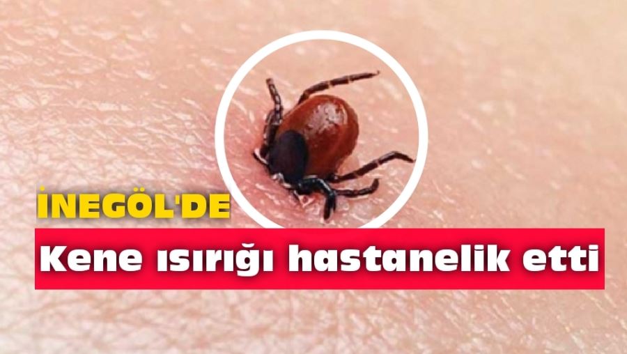 Kene ısırığı hastanelik etti