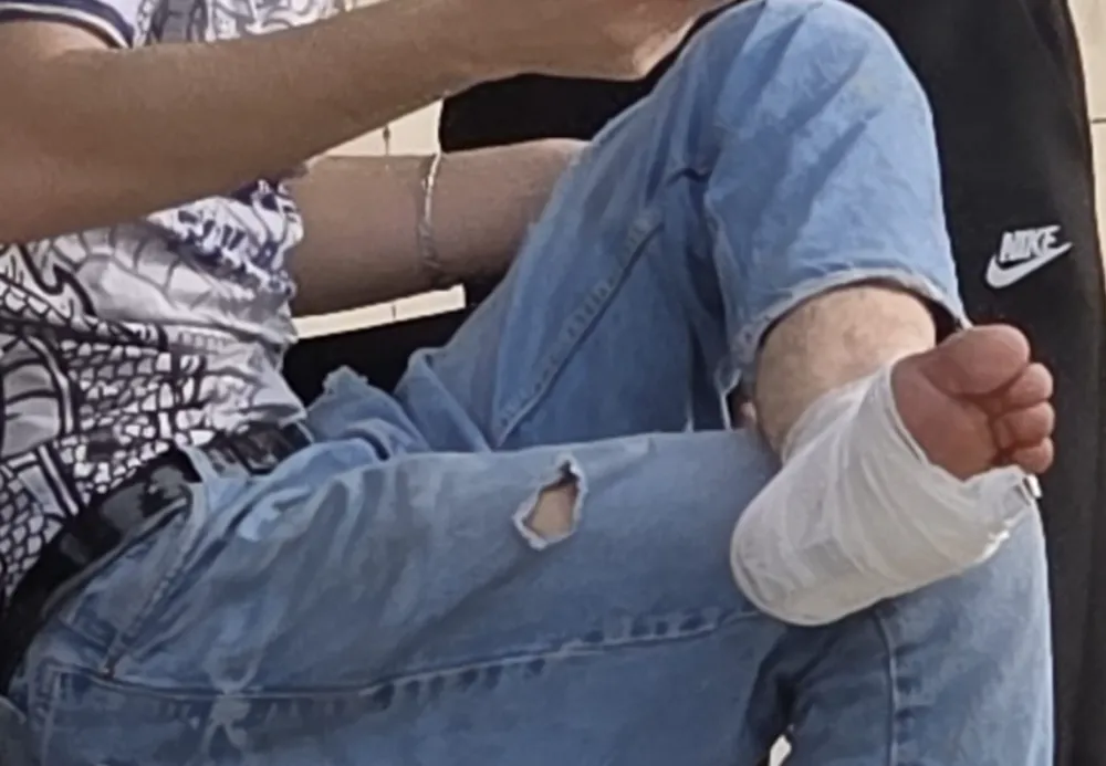 İnegöl’de Odun Keserken Baltayla Bacağını Yaraladı